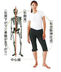 バランサーバンド