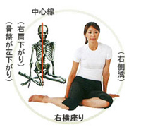 右肩がさがり、骨盤が左に下がります